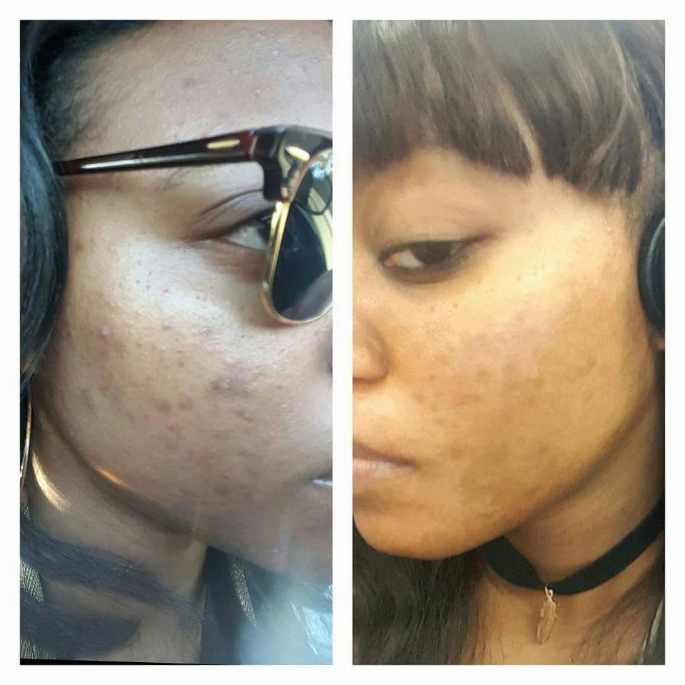 Why You Should Use A Toner