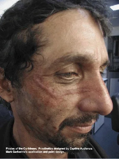 pirate_scar.jpg