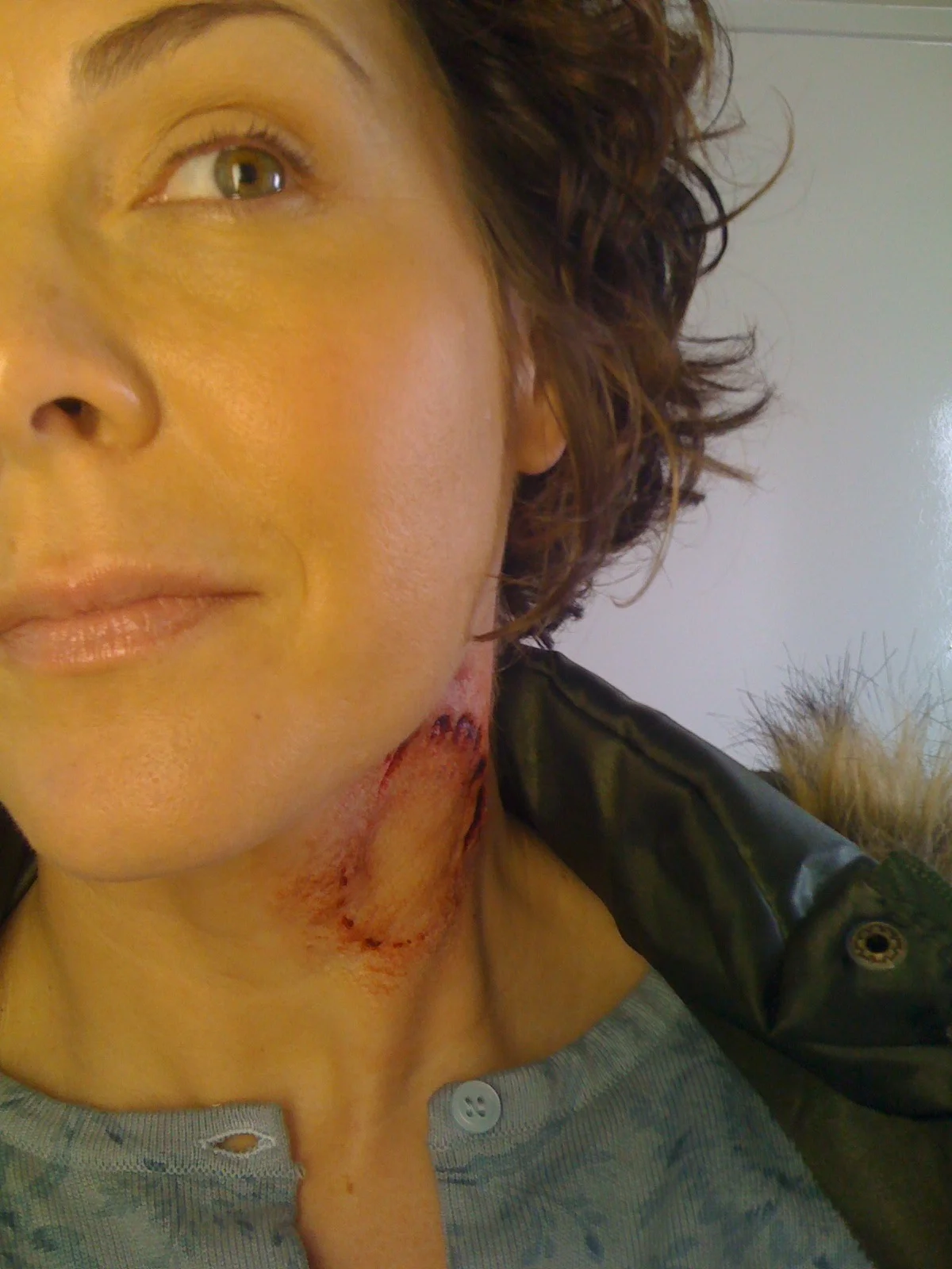 Ouch! That's Gonna Leave A Mark
