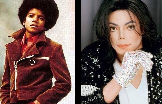Michael Jackson. It doesn't matter if you're black or white (as long as you're whiter)