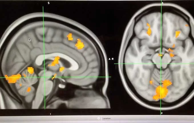 These areas of the brain uniquely activate in people with higher empathy when they listen to music. SMU, UCLA