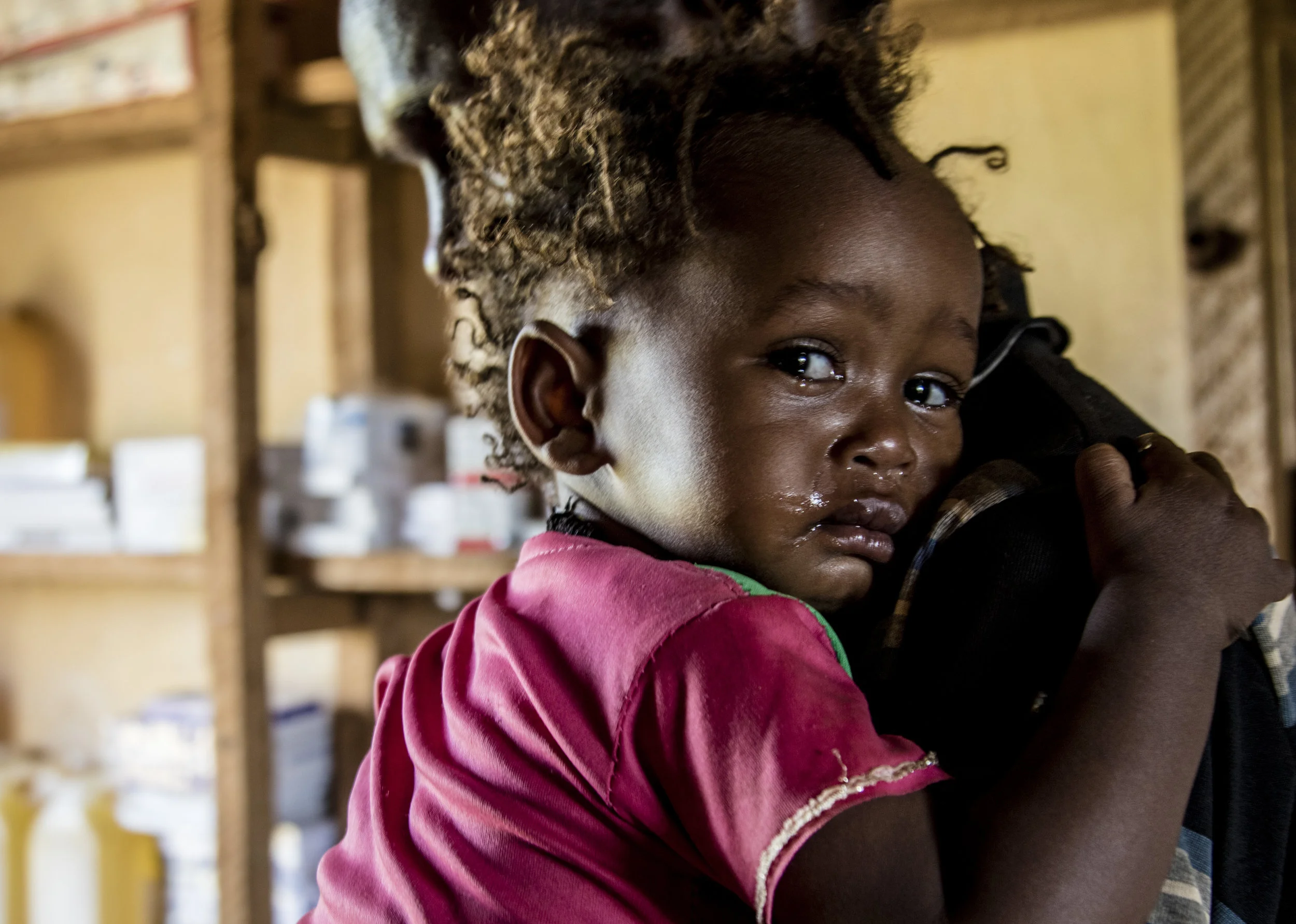 April 1, 2018, Dambala Fachana, Kenya- A young refugee girl, 1 and a half years old, cries as she gets the bandage of her boil taken off.