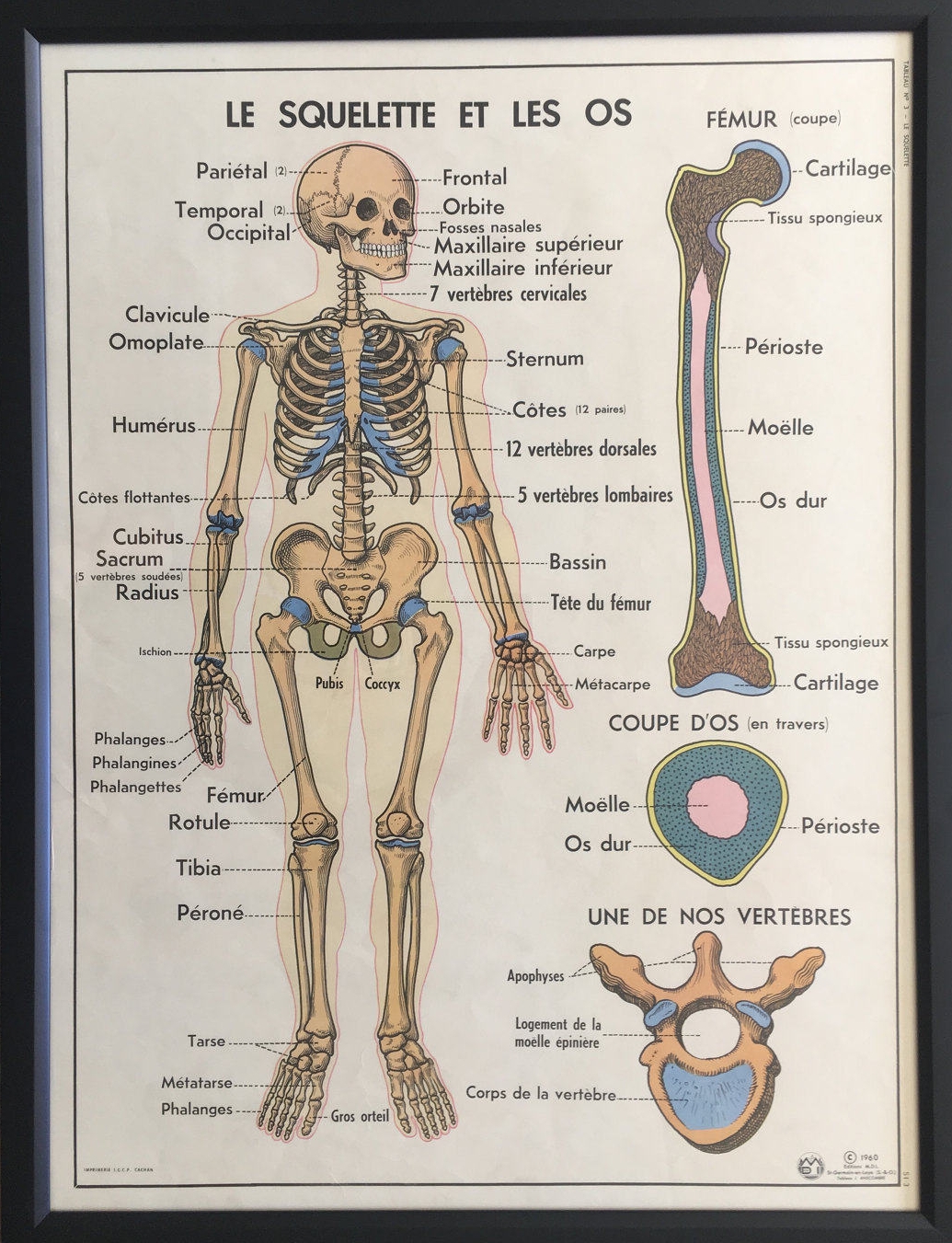 FRAMED Vintage French Medical Anatomy Education Poster- Skeleton and Bones