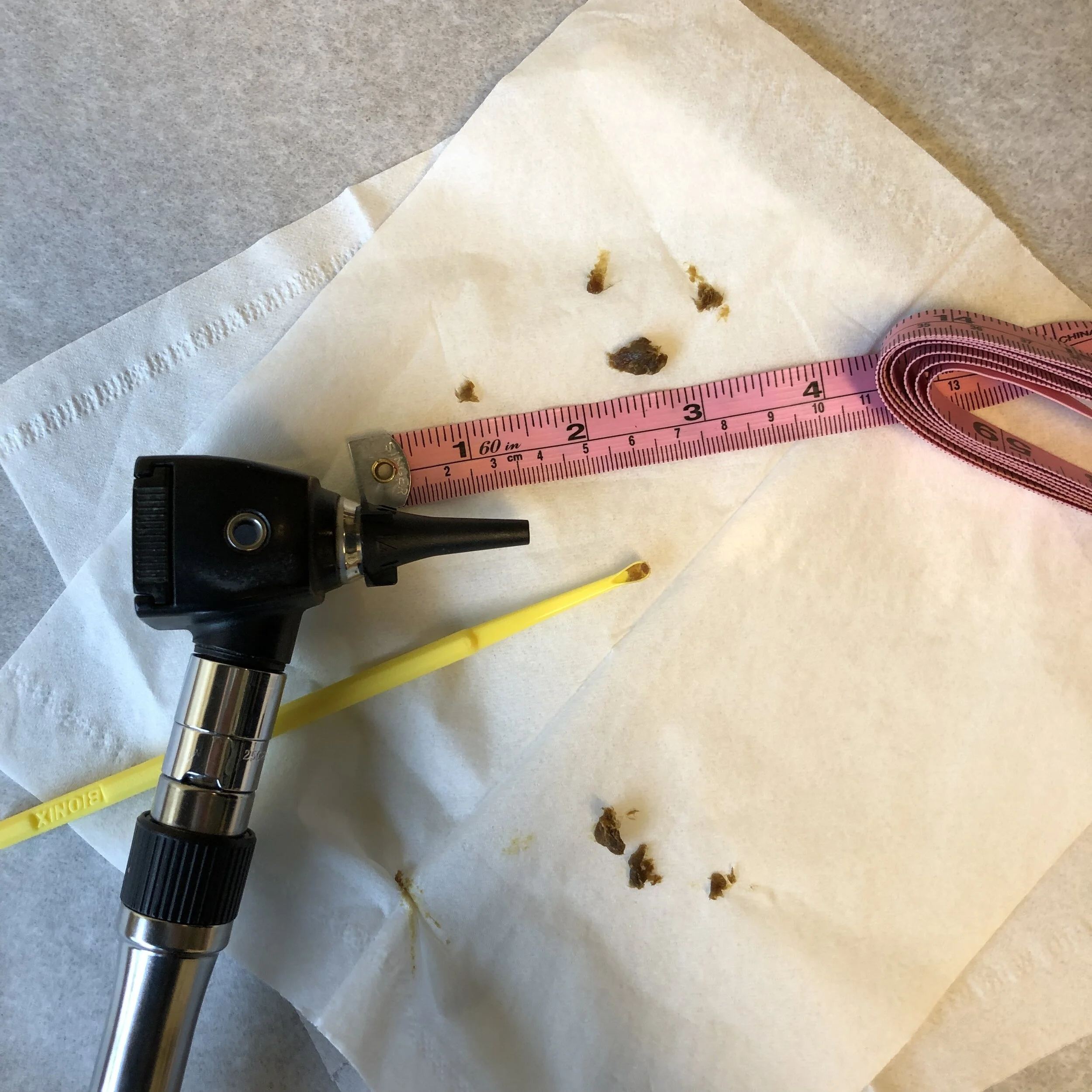 With a flick of the wrist we can remove a significant amount of cerumen (ear wax) that may be impairing your hearing. There is no charge for this cerumen disimpaction procedure in our office.