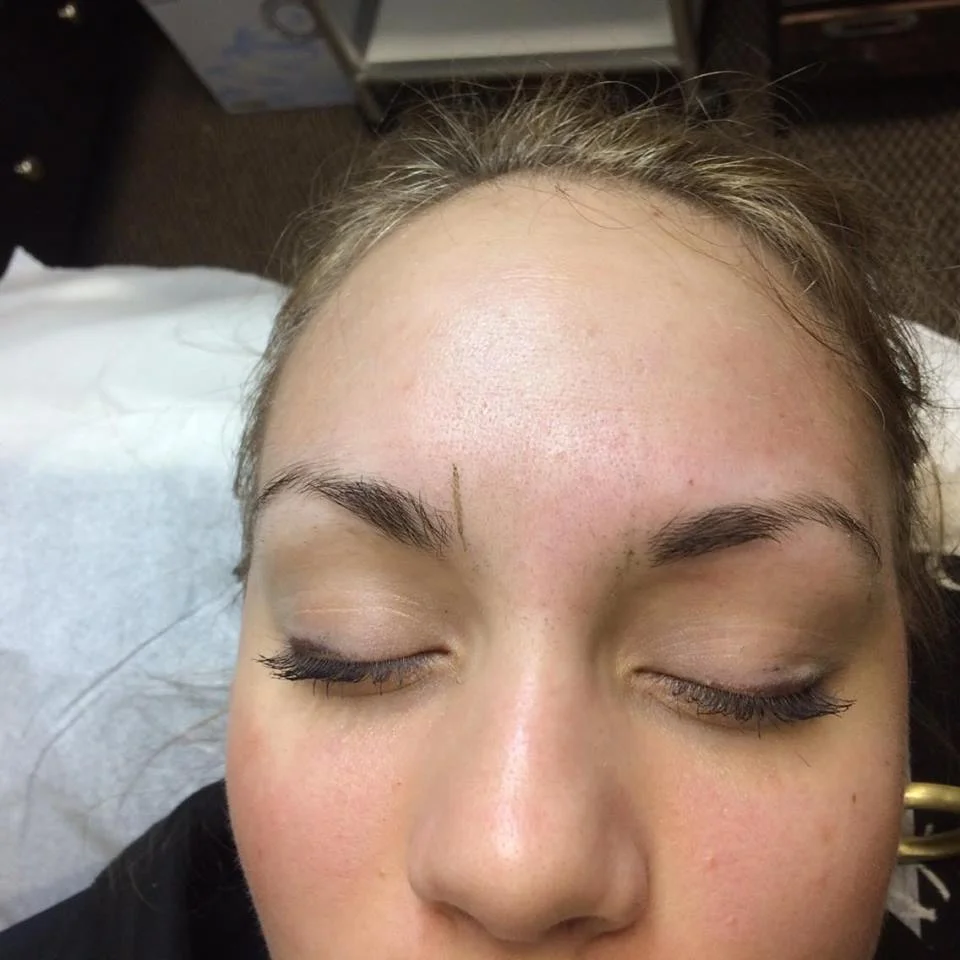 Natural Brow Restoration Therapy- Before