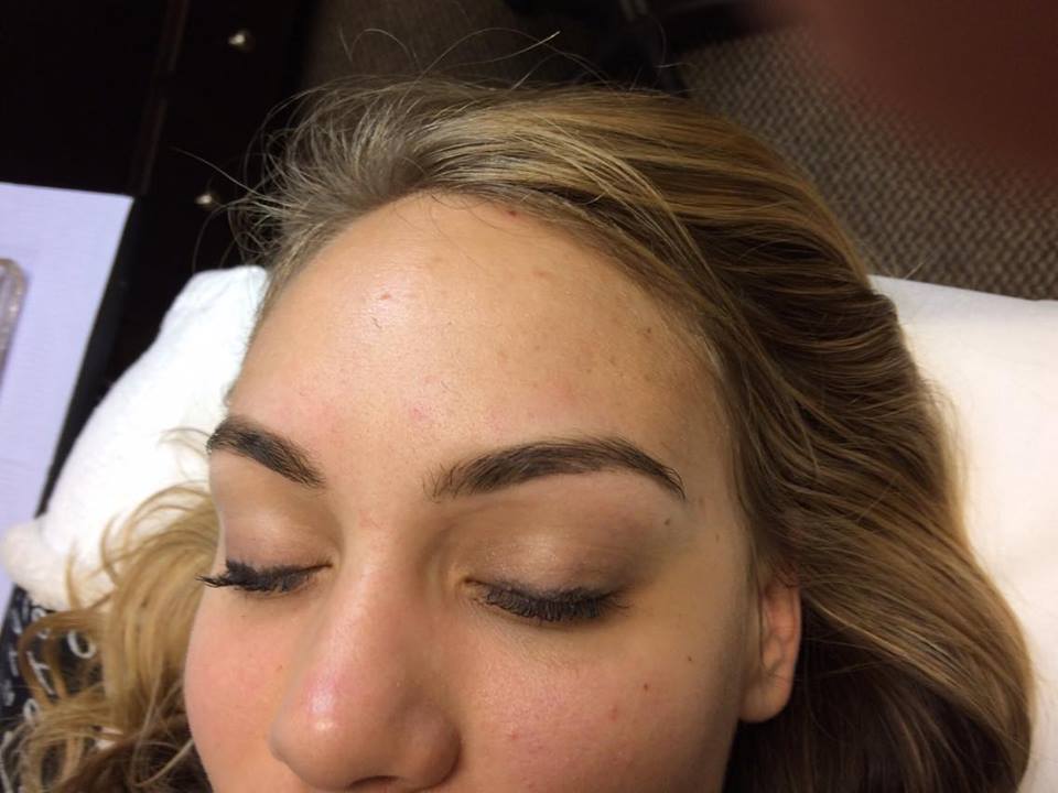 Natural Brow Restoration Therapy - After