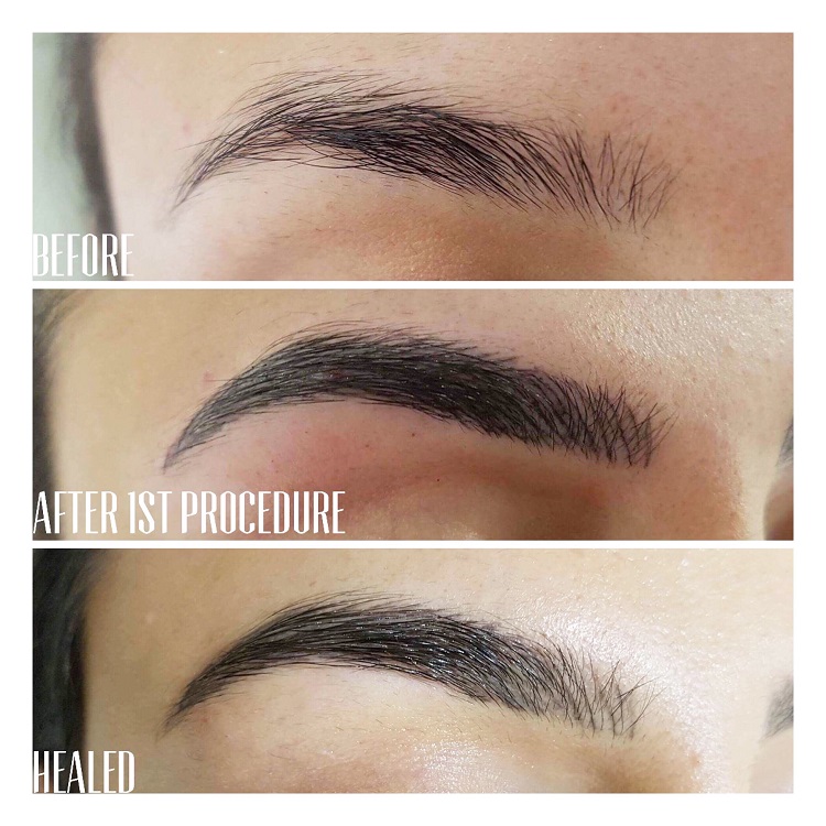 Microblading