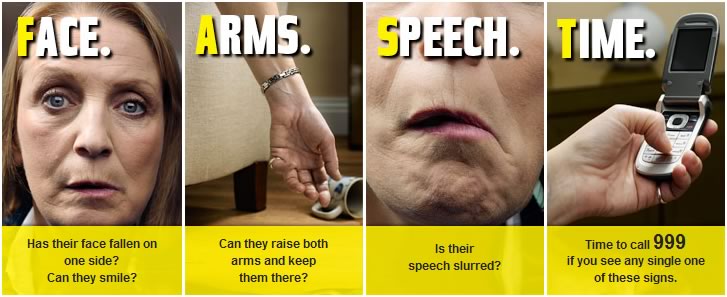 Here's a reminder of how we can identify a stroke in others, and act FAST to help