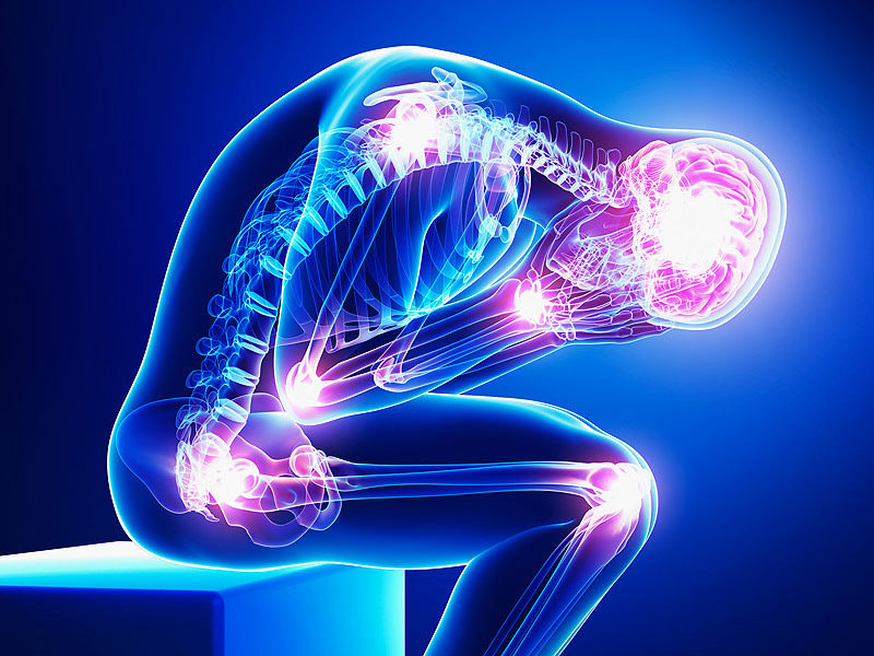 Fibromyalgia can cause constant pain, each day choosing a different set of muscles to torment