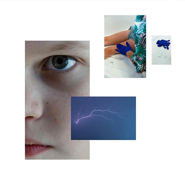 UNCONTROLLED EPILEPSY AND THE MEDICAL MARIJUANA TRIAL - Story excerpts from Australia
•
For full story go to www.alifeelectric.org ~Link in bio.
Follow Ella’s story @ellas_purple_promise