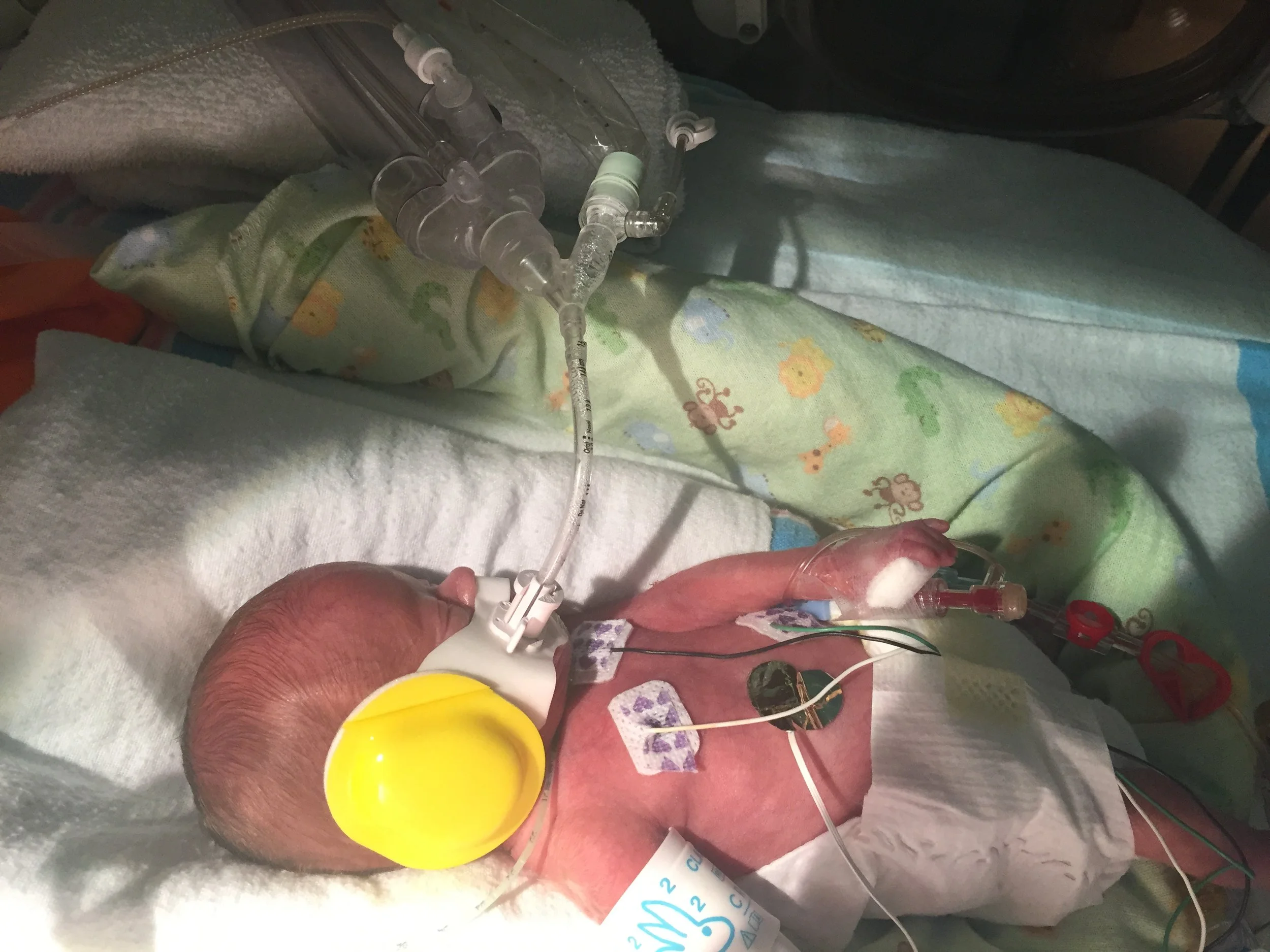 Kai with his earmuffs.JPG