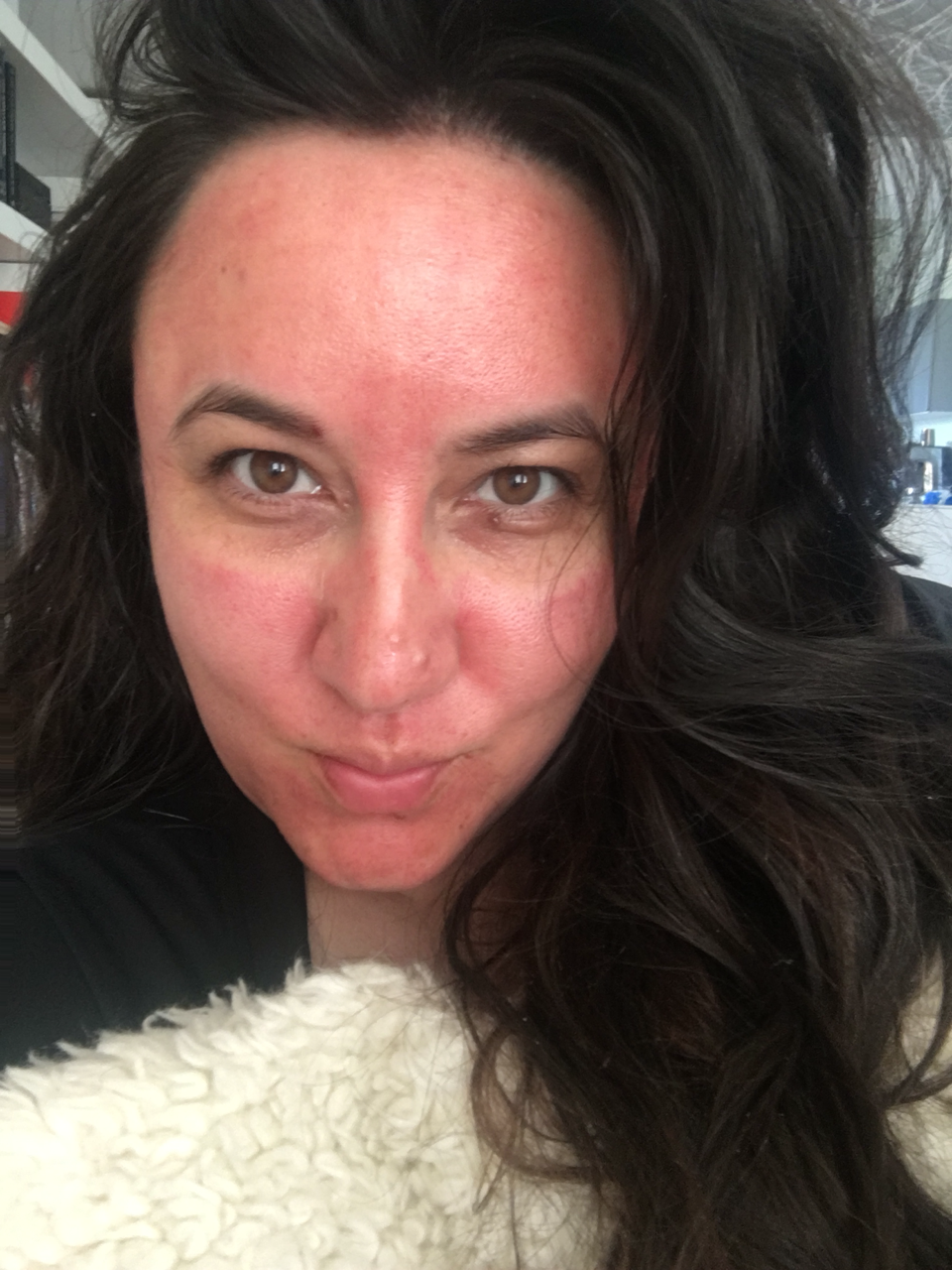 4 hours after the procedure