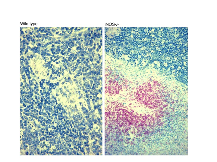  iNOS-deficient mice succumb to rapid growth of Mtb (PNAS 1997).
