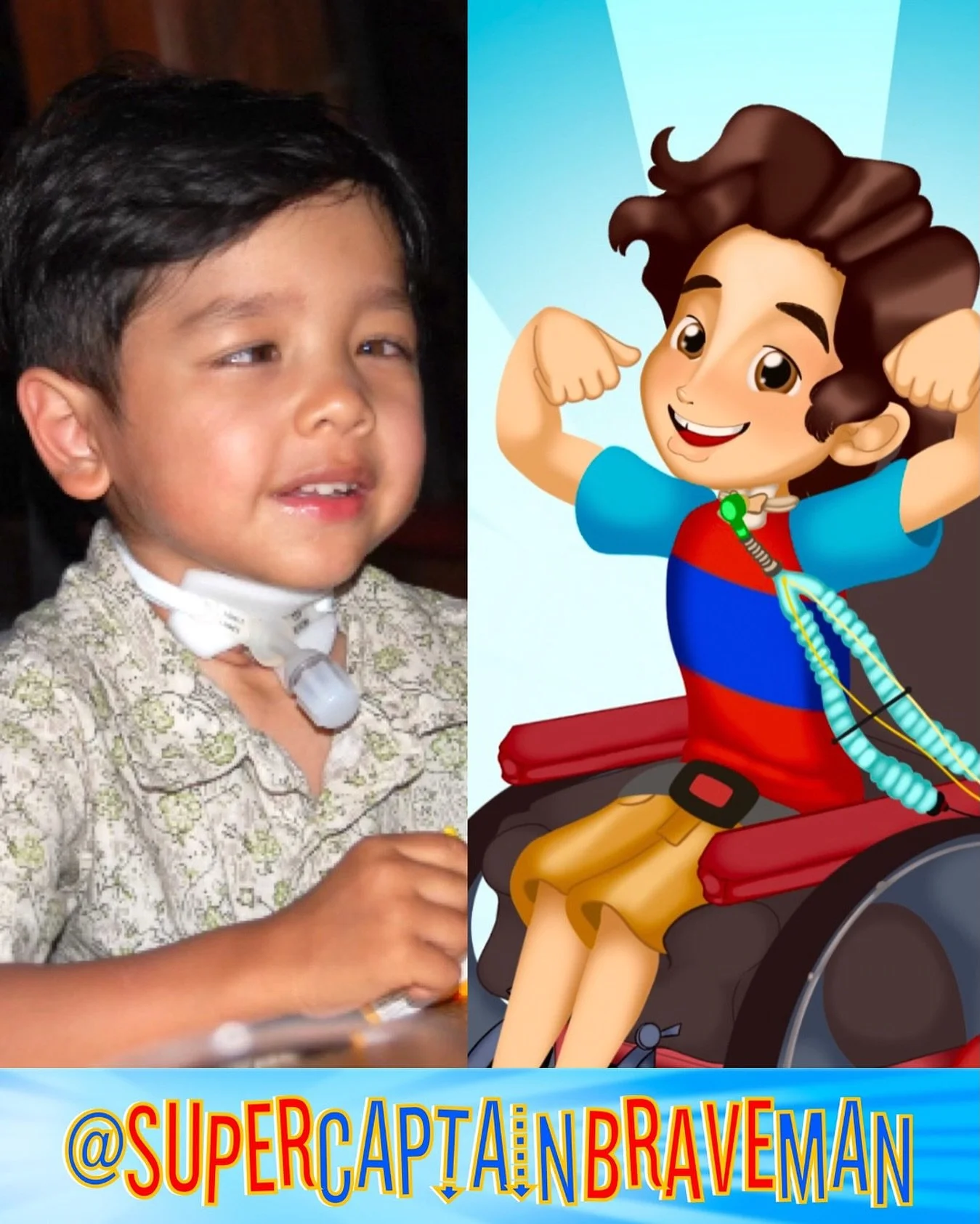 Kyle has extra special things that help him every day, like a ventilator for breathing, a feeding tube for eating, and a wheelchair that helps him get around!

Learn more about these amazing devices in A Kyle Adventure, the sister series of our Super
