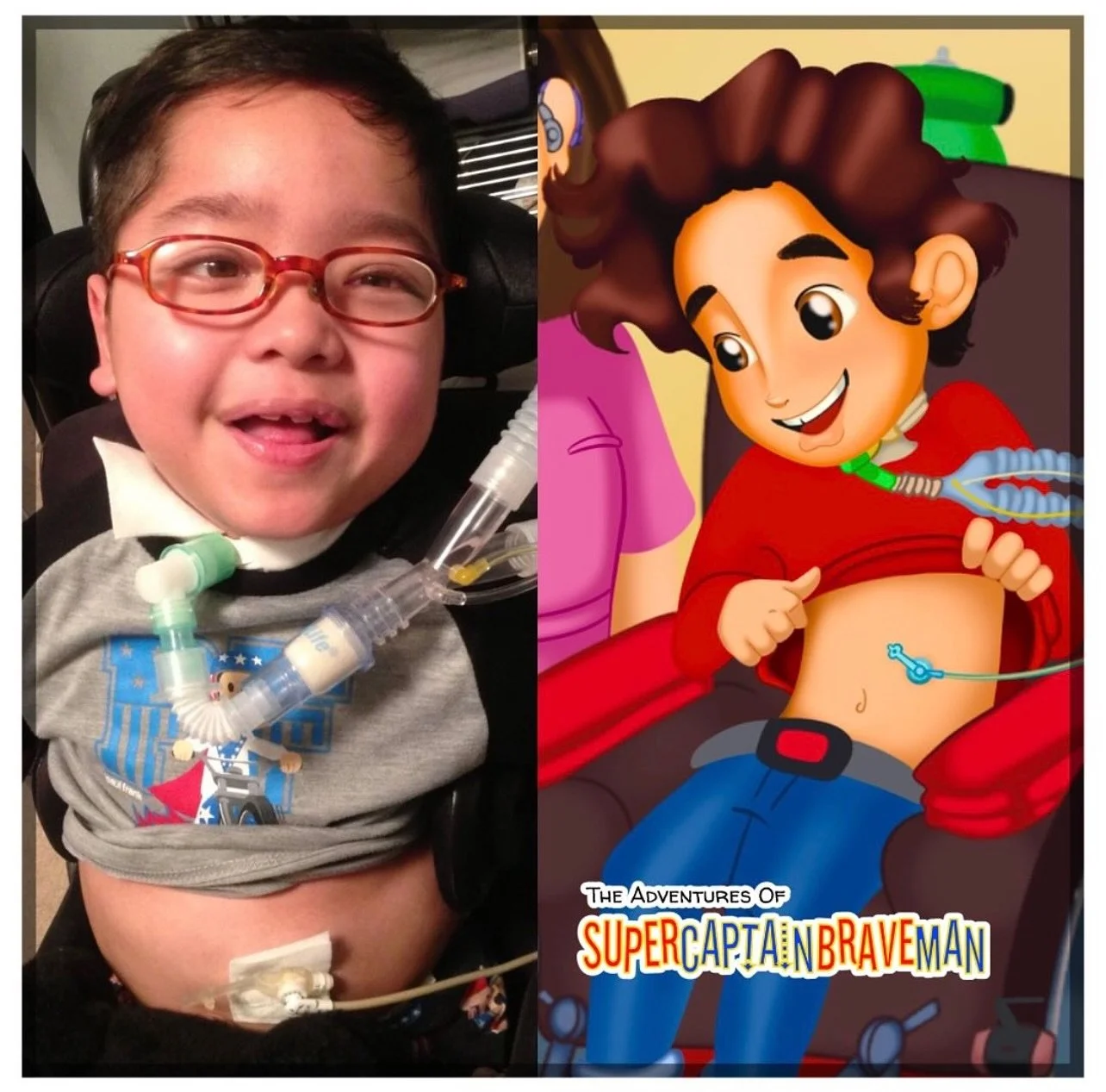 Start every day with a healthy and nutritious breakfast! Kyle receives his meals through his GTube. 
A GTube, or Gastrostomy Tube, is a surgically placed device in the belly that directly pipes enteral (liquid nutrition) formula into the stomach.
K