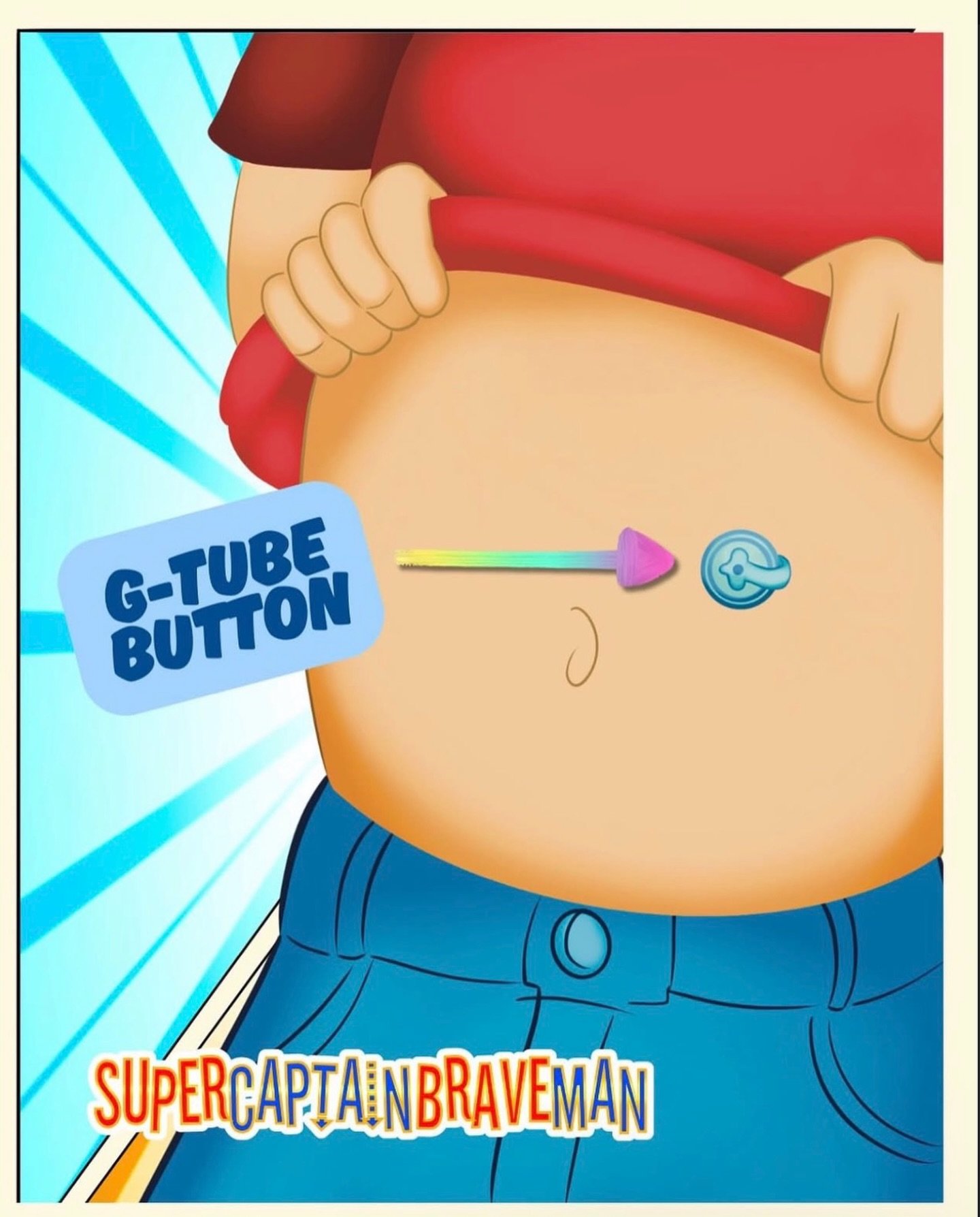 Kyle has a special button near his belly called his G-Tube Button! 

When it&rsquo;s time to eat, Kyle gets liquid formula directly into his G-Tube button and straight to his tummy!

Learn more about the special things Kyle uses every day in our Supe