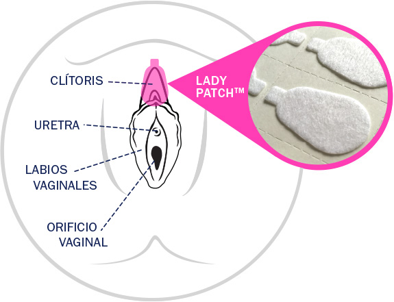 Lady Patch™. CómoFunciona.