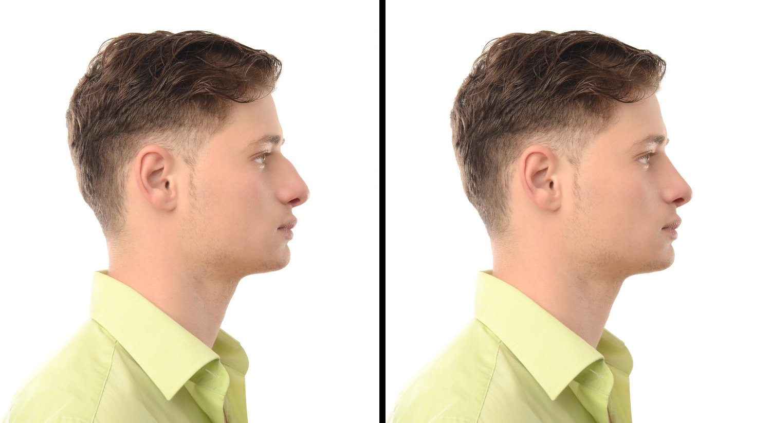 Ideal Skin Liquid Nose job Men.jpeg