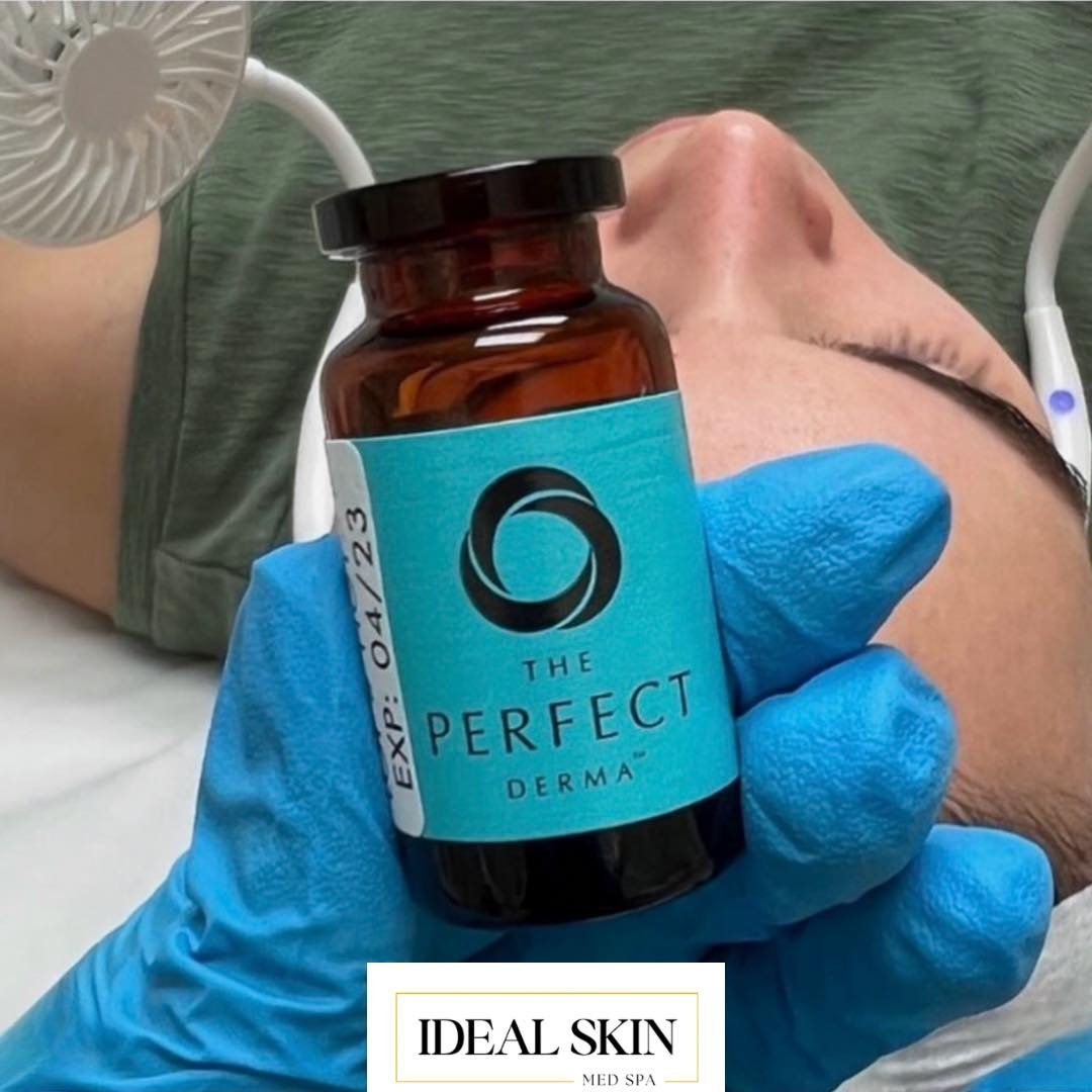 Have you tried our Perfect Derma Peel yet? 

THE PERFECT DERMA&trade; PEEL
The ONLY Medium Depth Medical Grade.
Chemical Peel with Glutathione. 
It provides healthy, ageless skin for all skin types and ethnicities.
Book with us today at idealskinfw.c