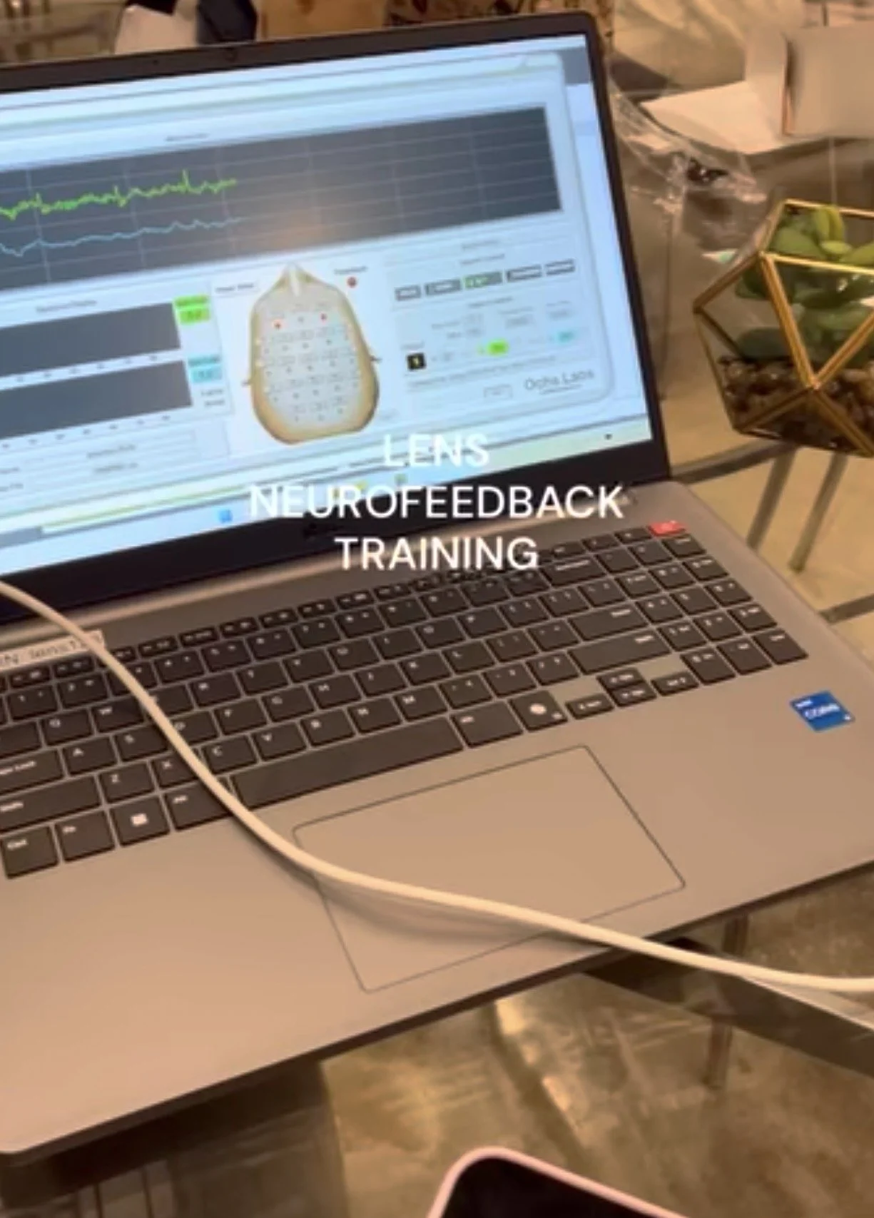 Part 2: My Daughter's Experience with LENS Neurofeedback