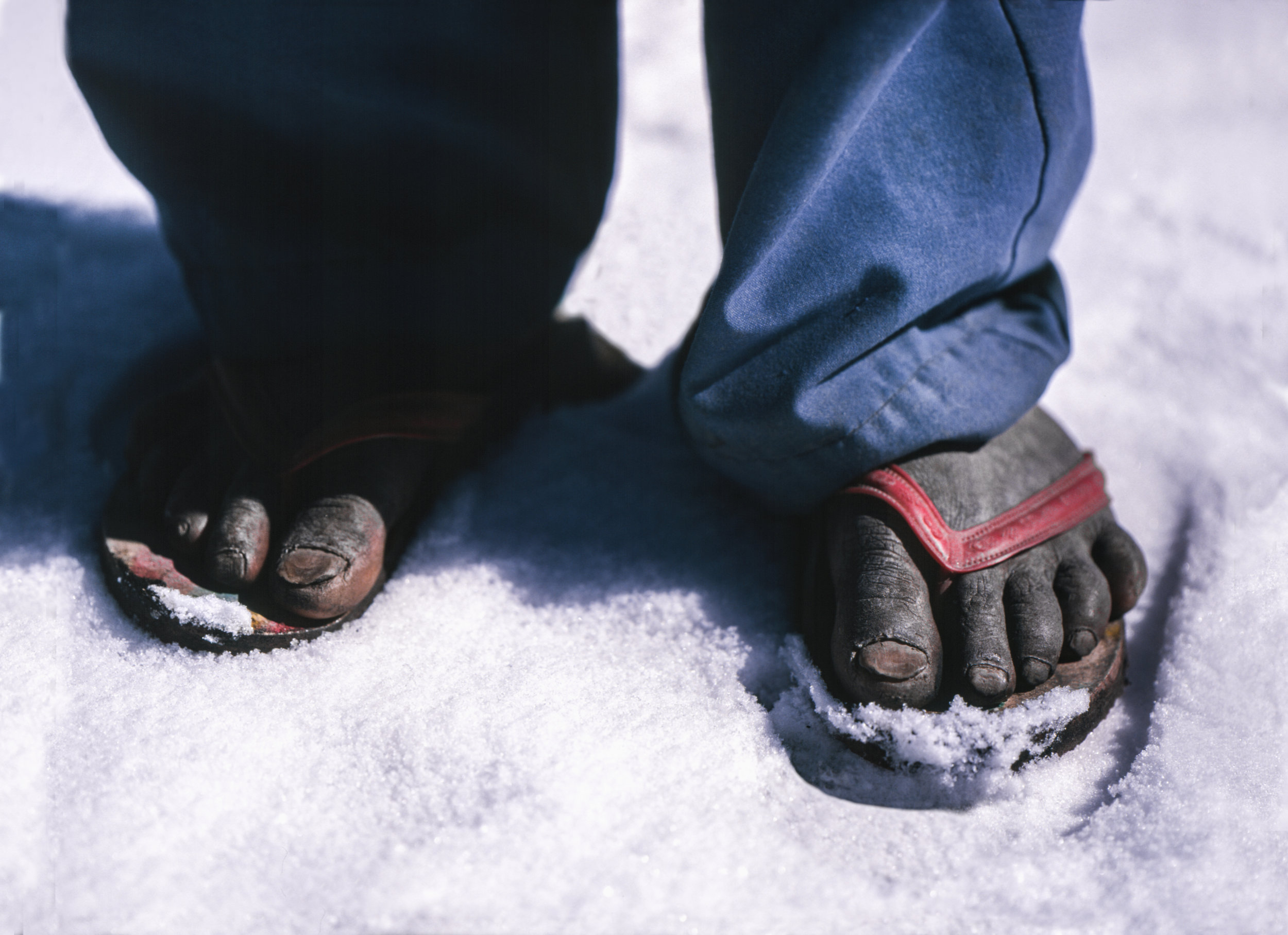 feet-snow-2.jpg