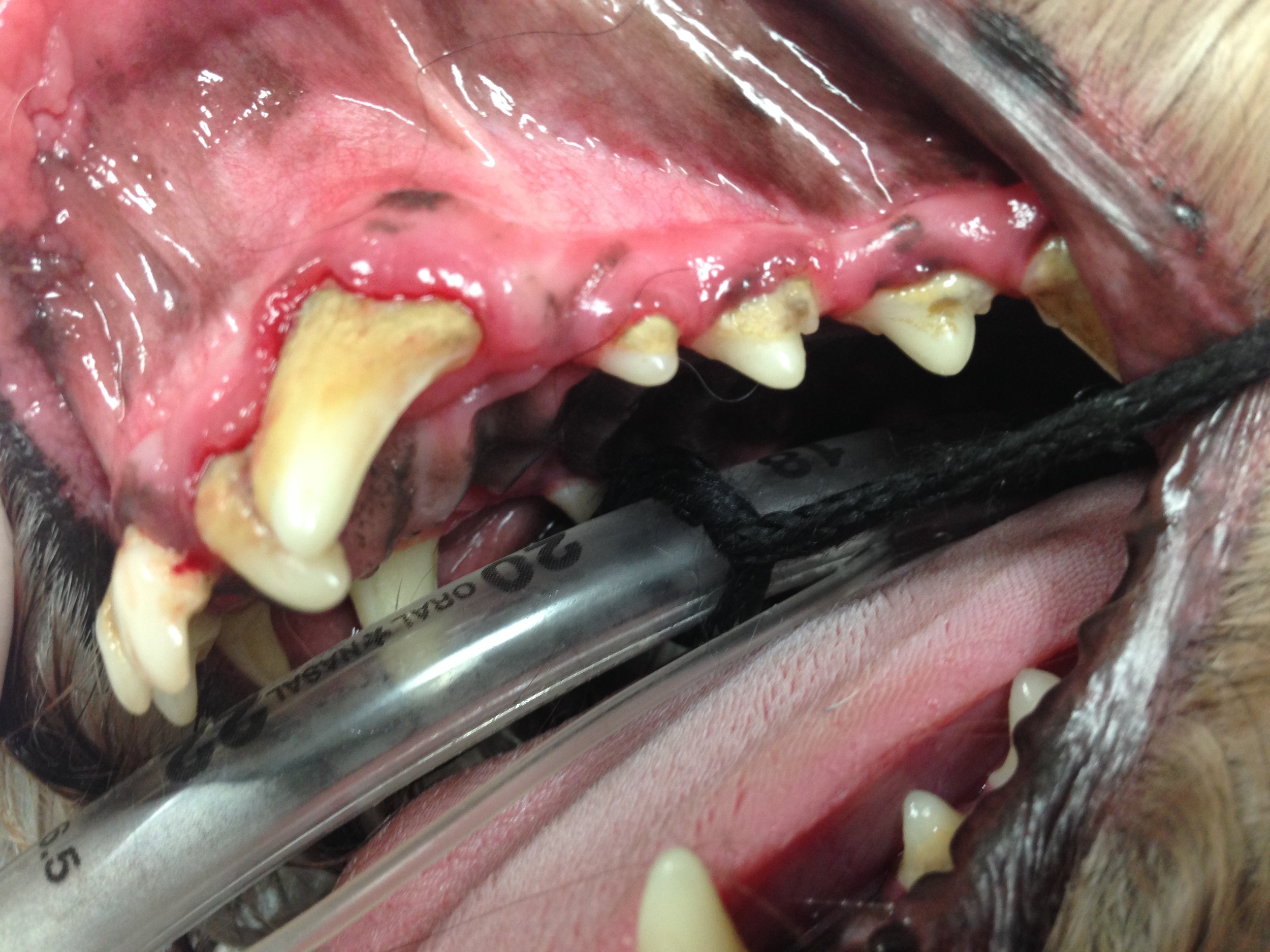 Gingivitis and receding gums