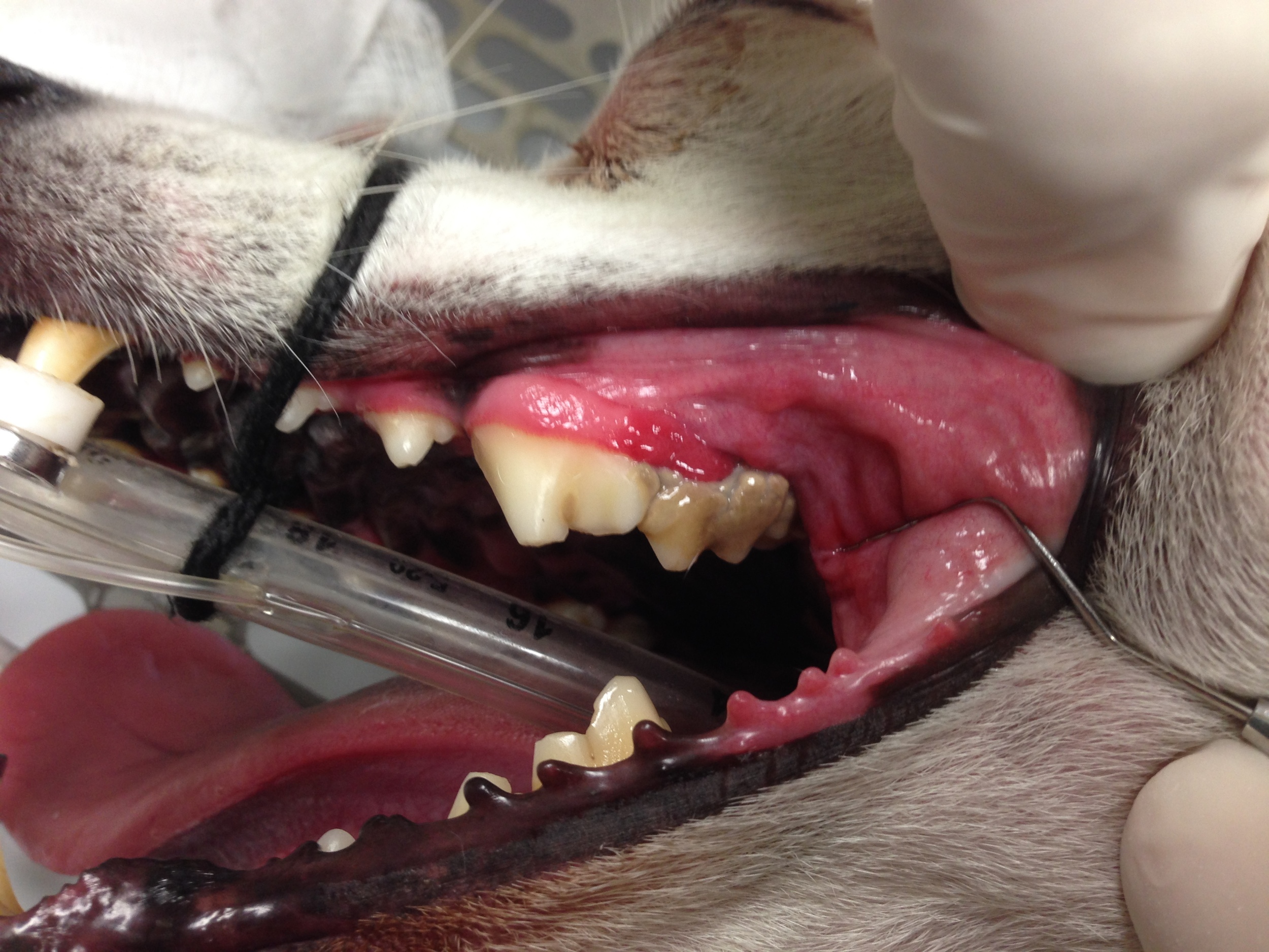 Severe Periodontitis (Rotting Teeth)