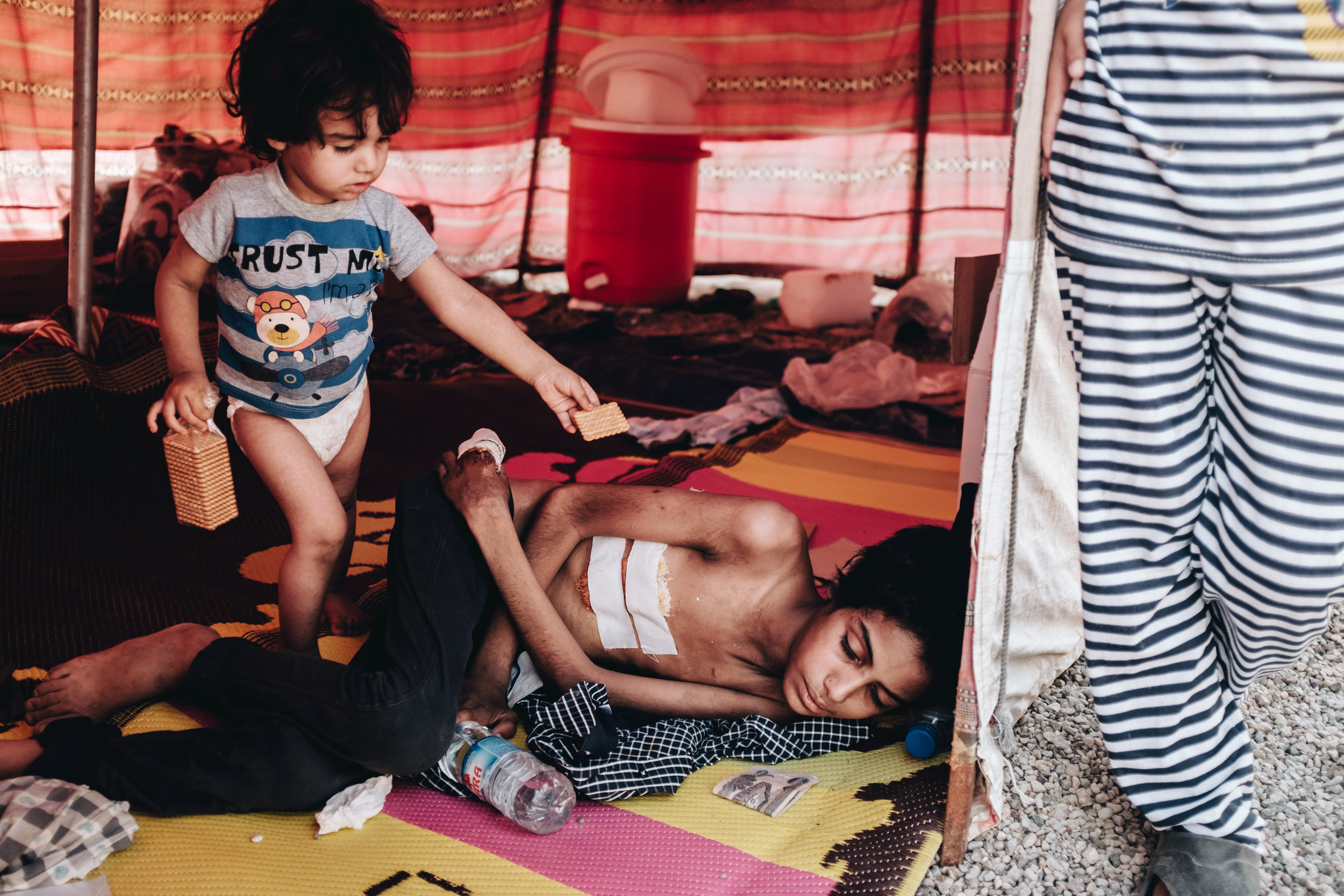 A young boy suffering from malnutrition and other injuries lies in the doorway to his family's tent whilst one of his siblings offers him a biscuit. A volunteer from a local NGO placed a bottle of water and some money next to him after his mother told him that her son was going to die.