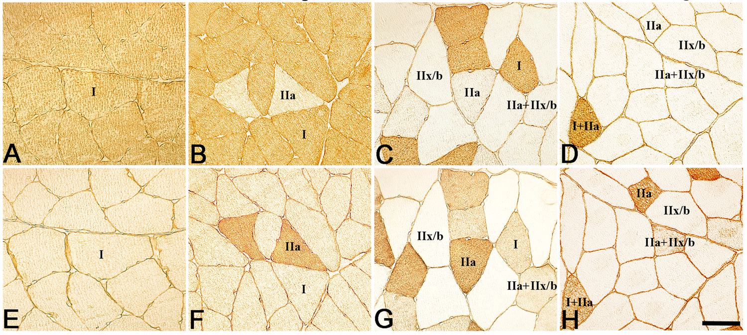 Images are paired top to bottom. From: Unilateral Muscle Overuse Causes Bilateral Changes in Muscle Fiber Composition and Vascular Supply ( https://doi.org/10.1371/journal.pone.0116455 ).