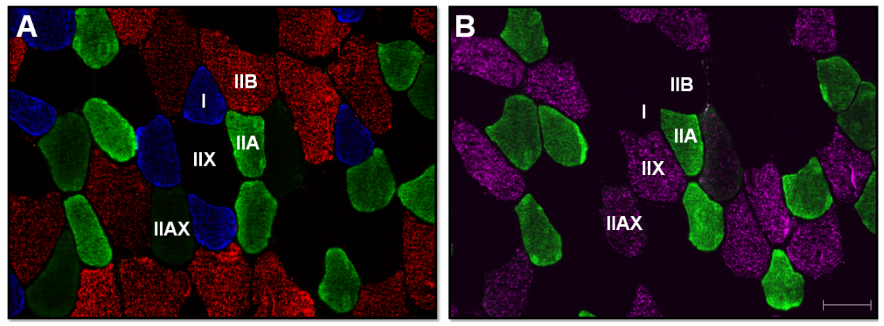 From: Rapid Determination of Myosin Heavy Chain Expression in Rat, Mouse, and Human Skeletal Muscle Using Multicolor Immunofluorescence Analysis ( https://doi.org/10.1371/journal.pone.0035273 ).