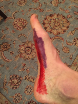 Abductor hallucis (red), flexor hallucis brevis (purple)