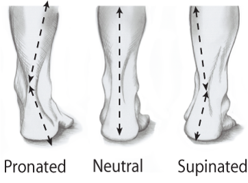 I need help please. Am I Pronation, Neutral and or Supination