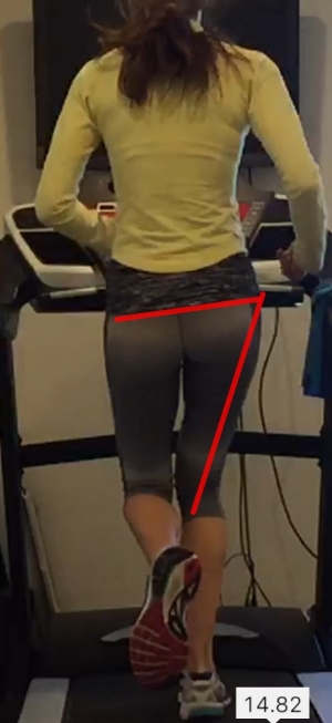 Poor right hip abductor engagement