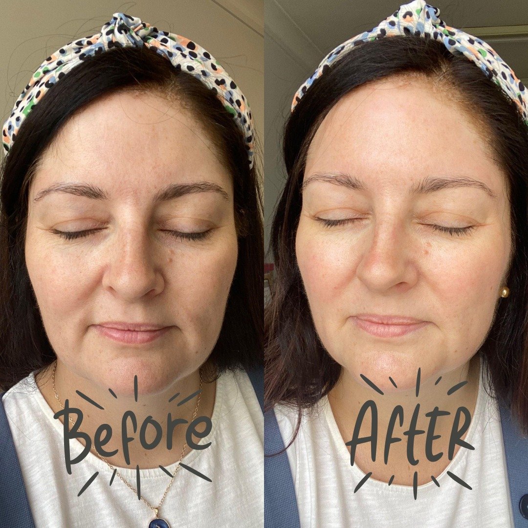 ✨Immediate Results✨

We know we haven't stopped talking about it recently, but seriously, can you blame us? 

These photos were taken right before a Luminant facial, and then again straight after, and the results are amazing. 

After just one treatme