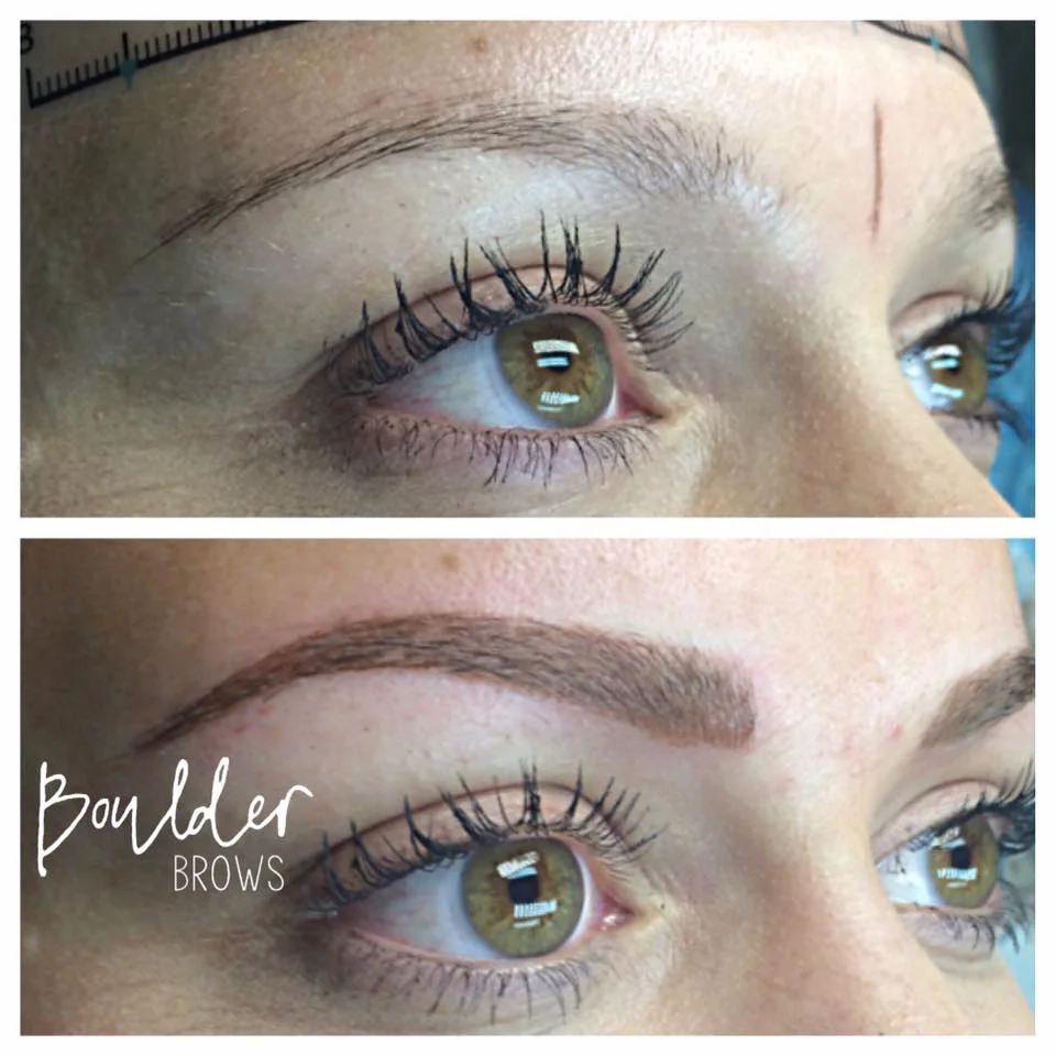 Top: Healed from 1st Session | Bottom: After Touchup