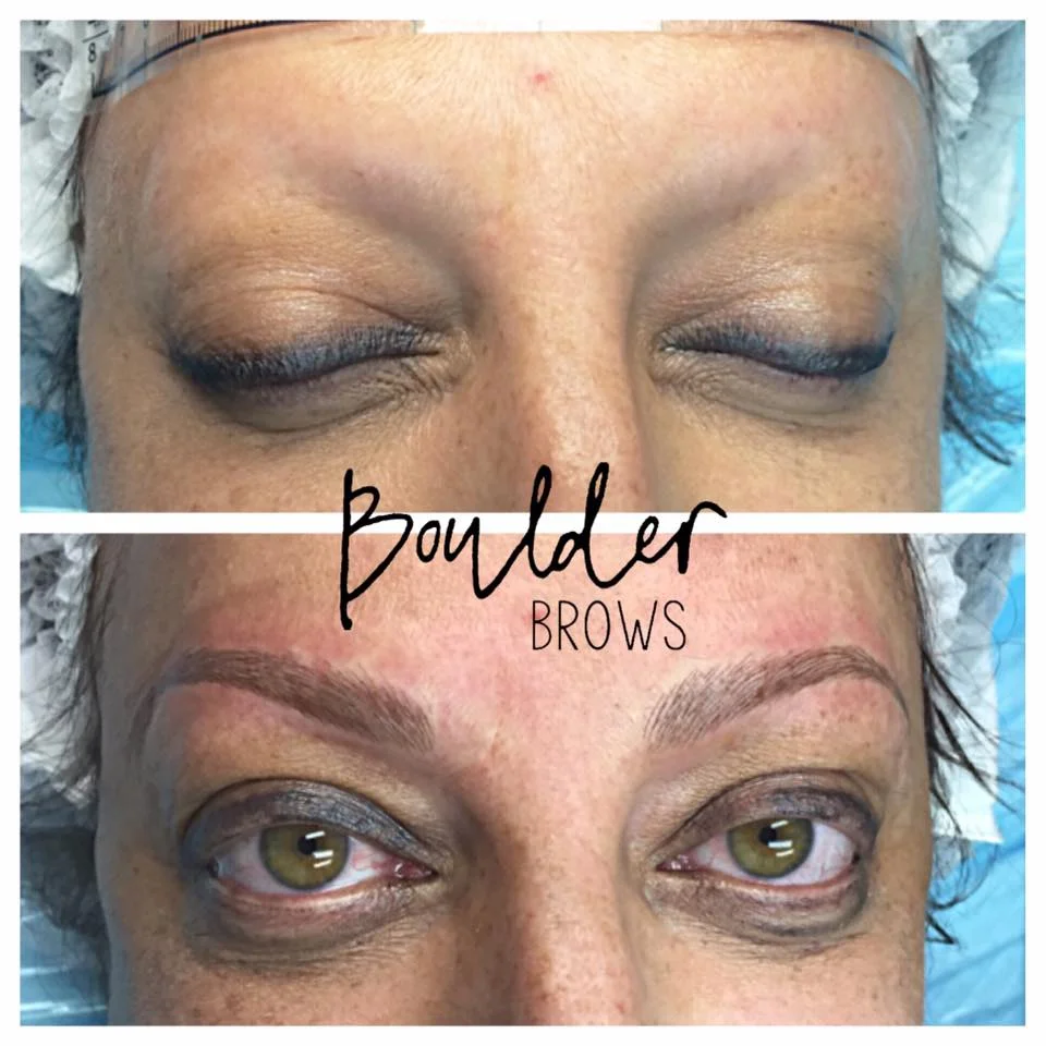 Top: Before | Bottom: After Microblading