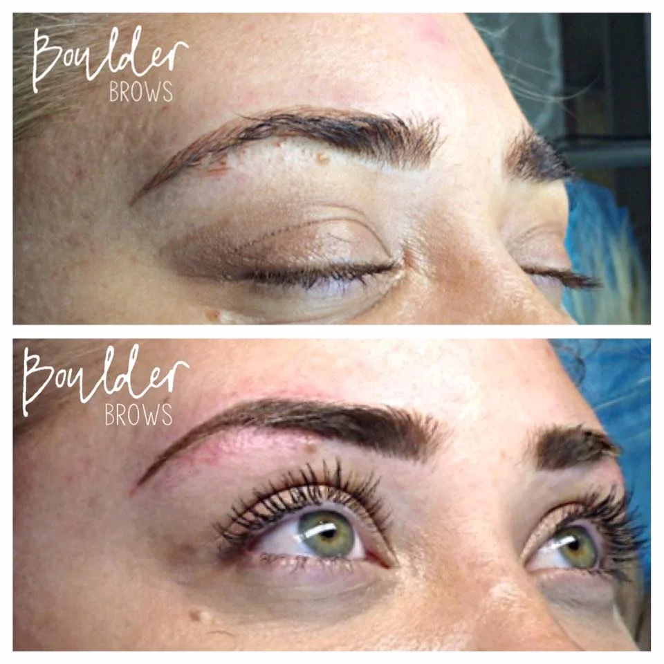Top: After 1st Session | Bottom: After Touchup