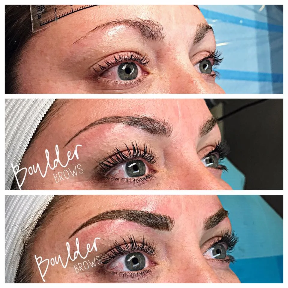 Top: Before | Middle: Healed After 1st Session | Bottom: Immediately After Touchup
