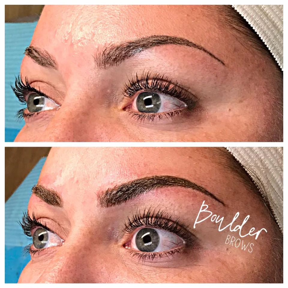 Top: Healed After 1st Session | Bottom: Immediately After Touchup