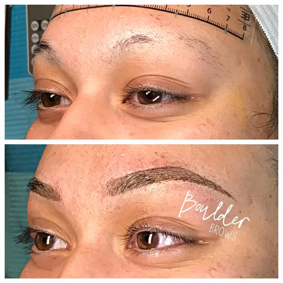 Top: Natural (Alopecia Client) | Bottom: After Microblading