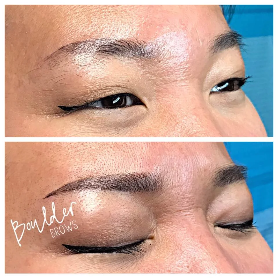 Top: Healed After 1st Session | Bottom: After Touchup