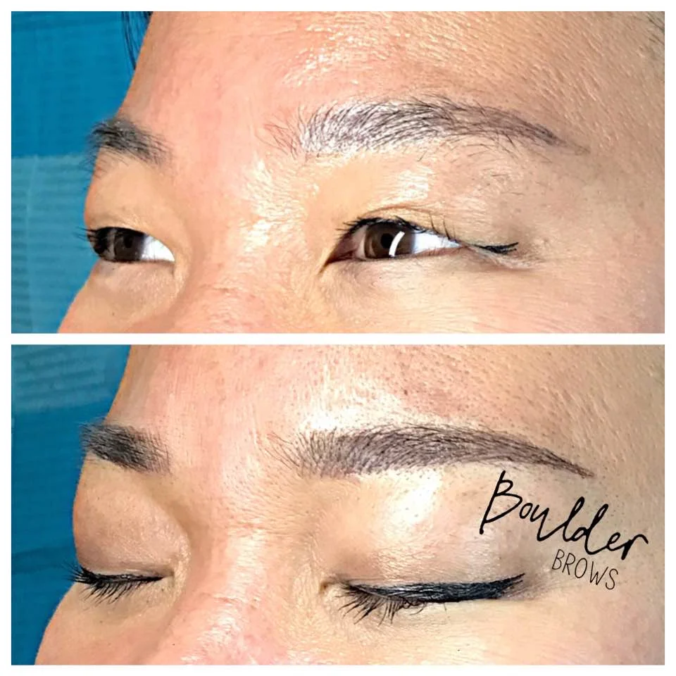 Top: Healed After 1st Session | Bottom: After Touchup
