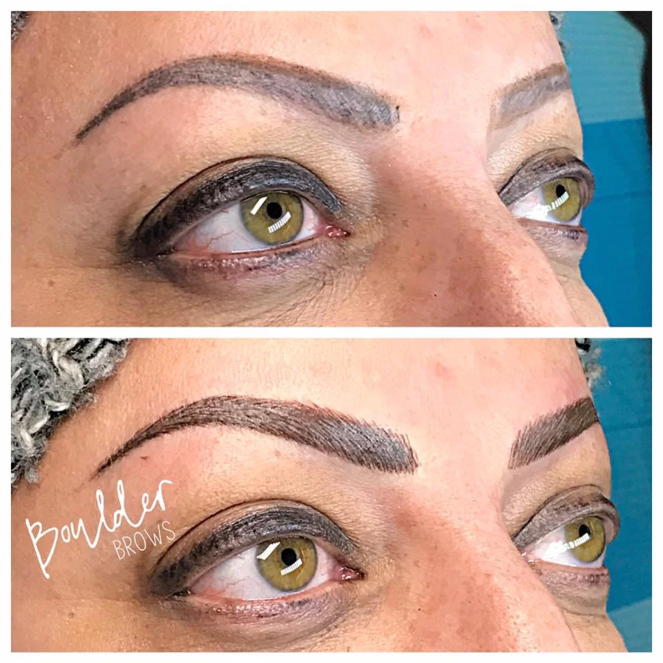 Top: Healed After 1 Touchup + Pencil Adjustments | Bottom: Immediately After 2nd Touchup