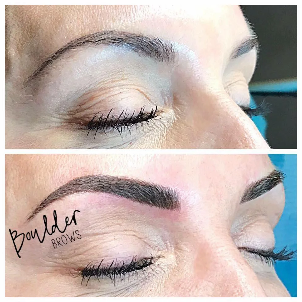 Top: Healed After 1st Session | Bottom: After Touchup