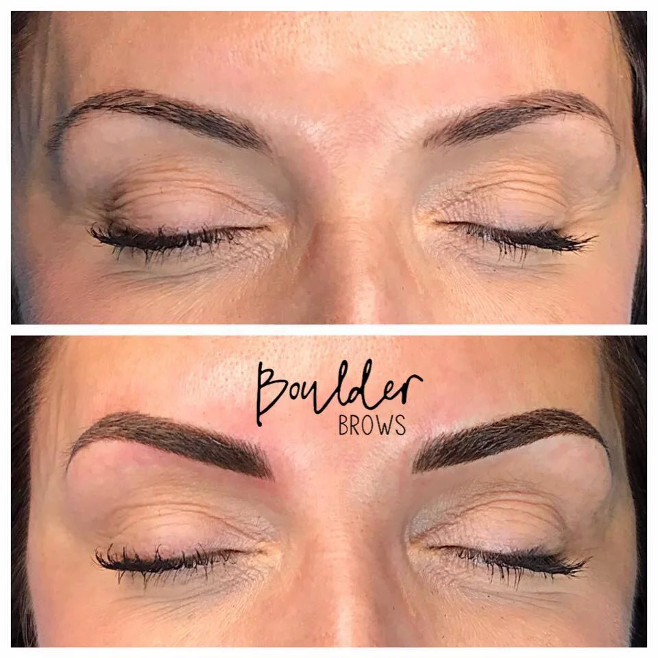 Top: Healed After 1st Session | Bottom: After Touchup
