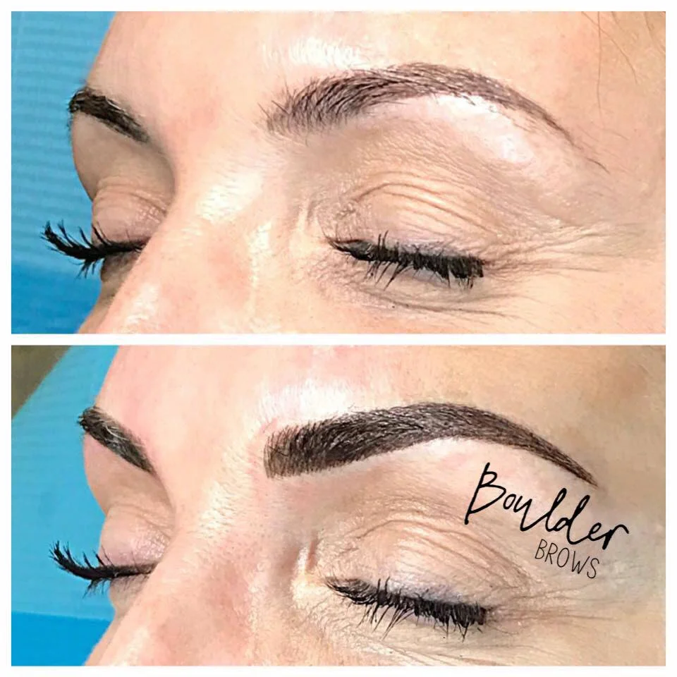 Top: Healed After 1st Session | Bottom: After Touchup