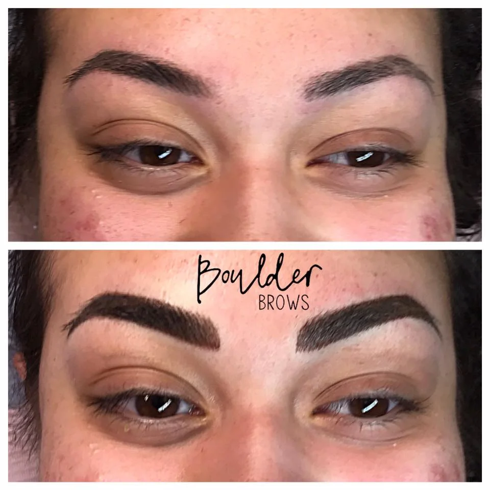 Top: Healed After 1st Session | Bottom: Immediately After Touchup