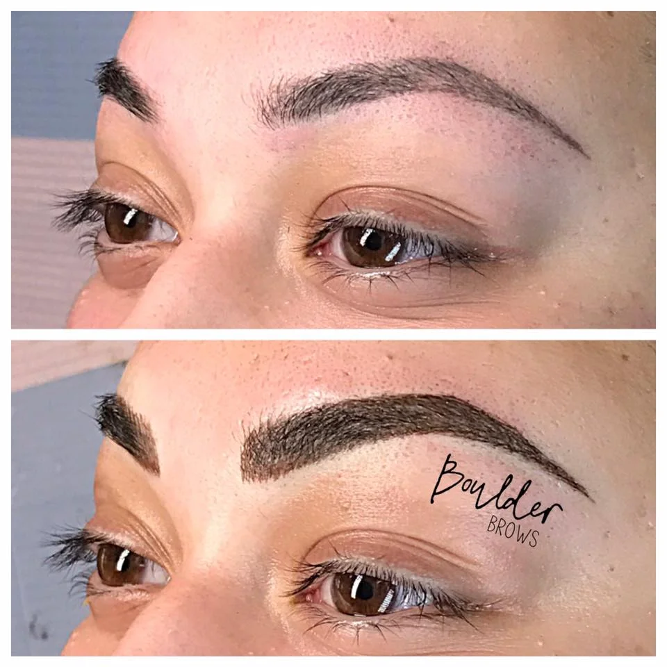 Top: Healed After 1st Session | Bottom: Immediately After Touchup