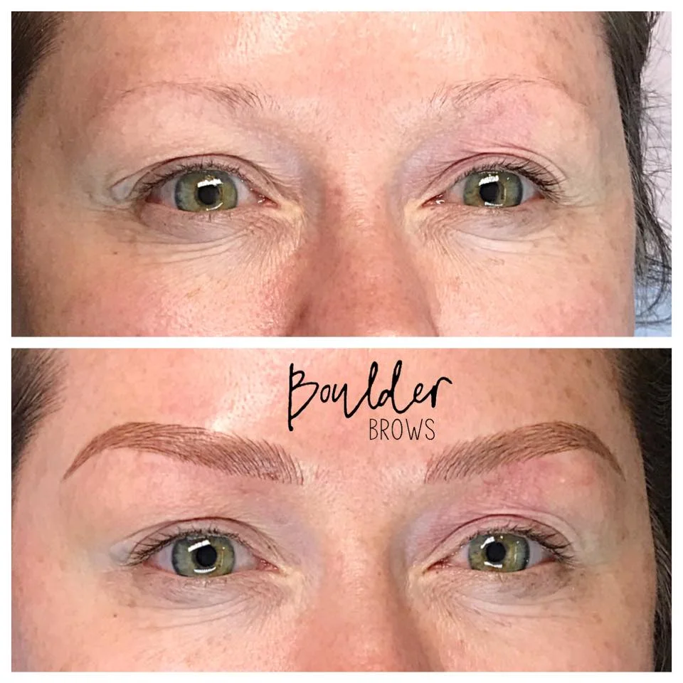1ST MICROBLADING SESSION Top: Before | Bottom: After