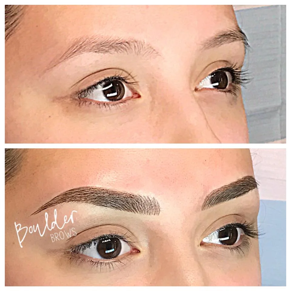 1ST MICROBLADING SESSION Top: Before | Bottom: After